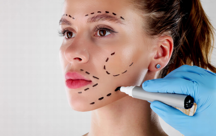 Adsız (140 x 120 piksel) (800 x 800 piksel) (218 x 335 piksel) (330 x 267 piksel) (145 x 152 piksel) (800 x 467 piksel) thread lift komplikasyonları ve sinir hasarı